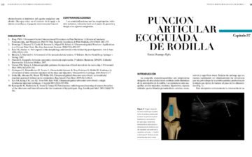 Cap. 37.- PUNCIÓN ARTICULAR ECOGUIADA DE RODILLA